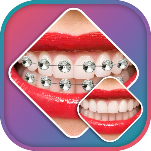 Braces Photo Editor -Braces Camera stickers