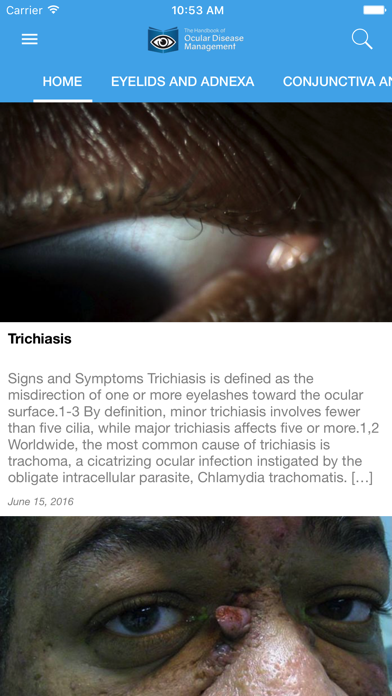 Ocular Disease Handbook screenshot 2