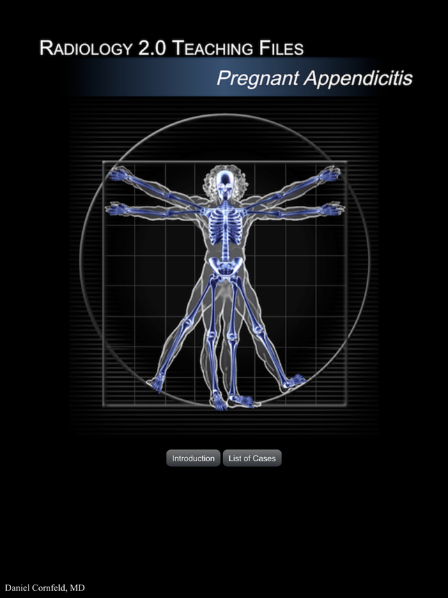 Radiology 2.0: Pregnant Appendicitis