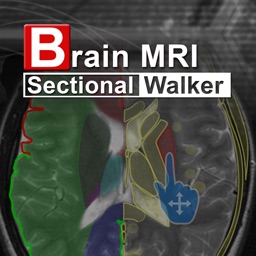 Brain MRI Sectional Walker