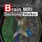 Brain MRI Sectional W...