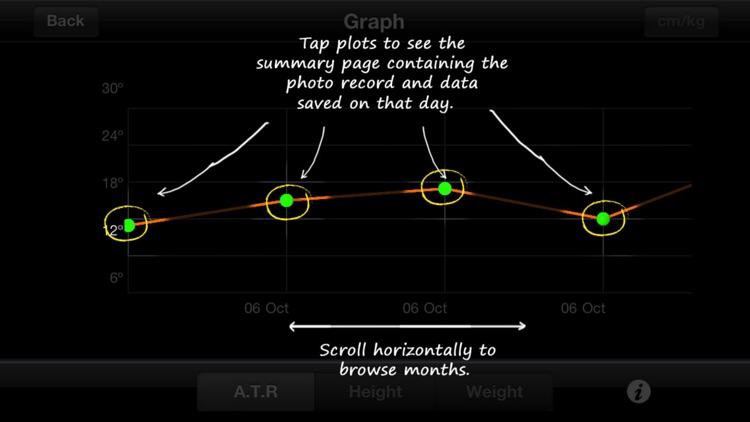 ScolioTrack screenshot-4