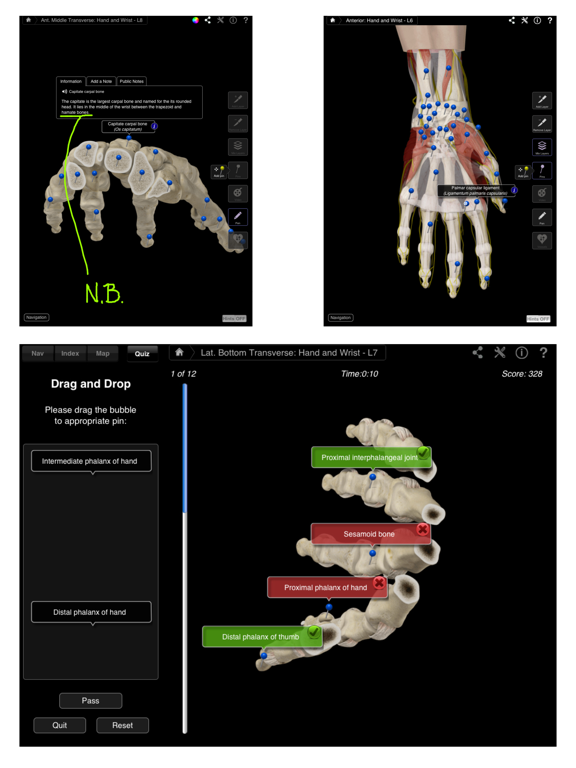 Hand & Wrist Pro III for iPadのおすすめ画像4