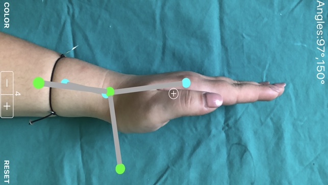 ARorthopaedicGoniometer(圖8)-速報App