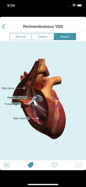 Heartpedia(圖5)-速報App