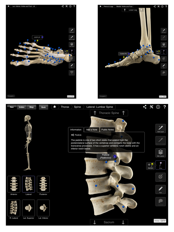 Skeleton System Pro III Screenshot 3