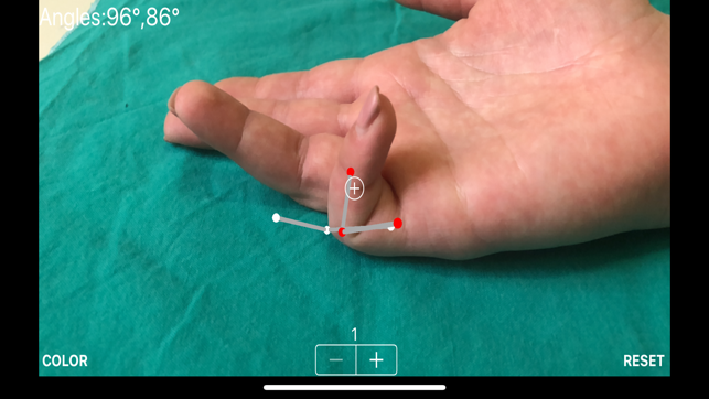 ARorthopaedicGoniometer(圖6)-速報App