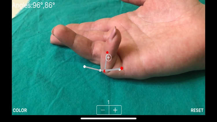 ARorthopaedicGoniometer screenshot-5