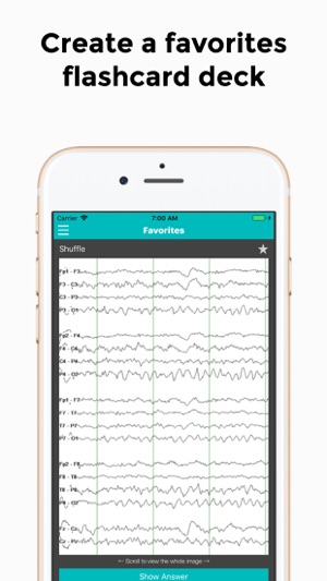 EEG(圖6)-速報App