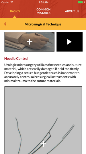 Male Infertility Microsurgery(圖4)-速報App