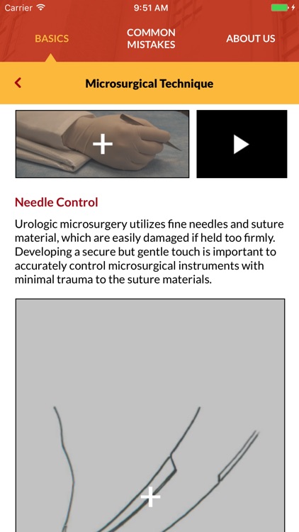 Male Infertility Microsurgery screenshot-3