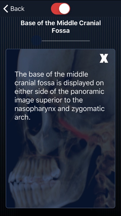 Dental Panoramic Radiology screenshot-4