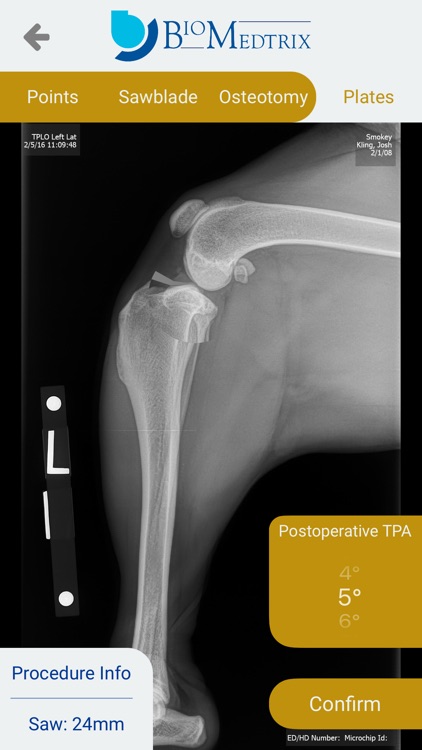 TPLO Templating screenshot-3