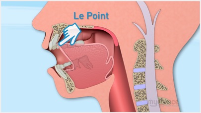 myobrace.基本信息