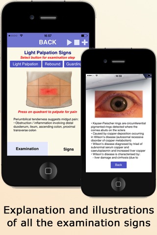 AnswersIn Abdominal Examination screenshot 3