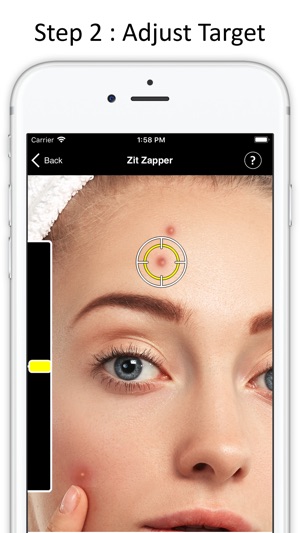 Zit Zapper - Remove Pimples(圖3)-速報App