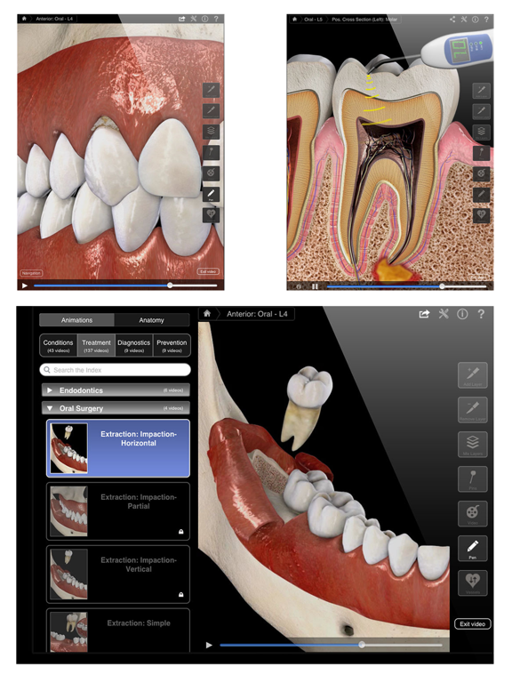 Dental Patient Education Liteのおすすめ画像2