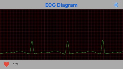 Jabil-ECG screenshot 3