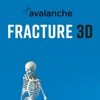 Fracture 3D