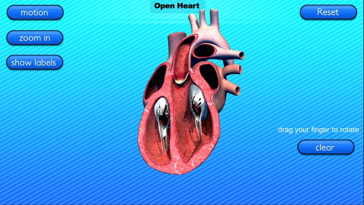Open Heart Motion