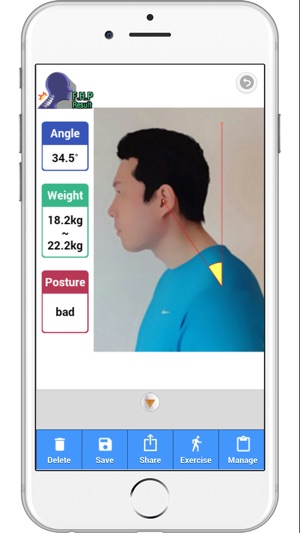 Forward Head Posture (FHP)(圖3)-速報App