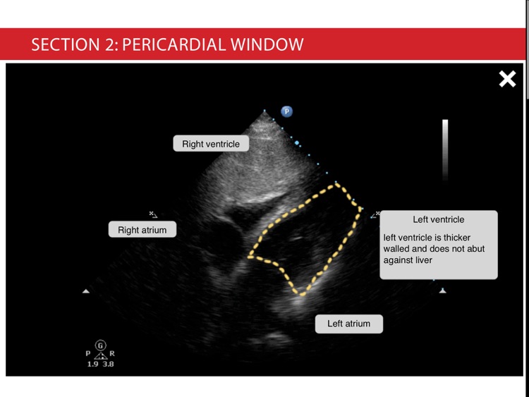 Trauma Ultrasound eBook screenshot-4