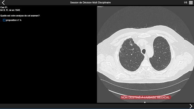 Fibrose pulmonaire 2017