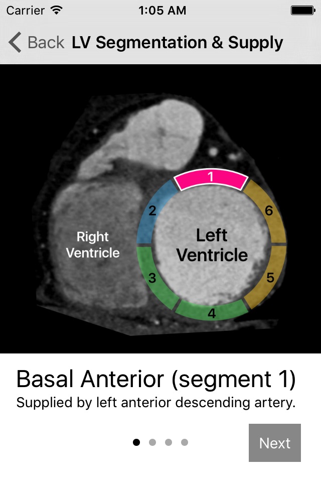 Cardiac Imaging Planes 1-2-3 screenshot 2