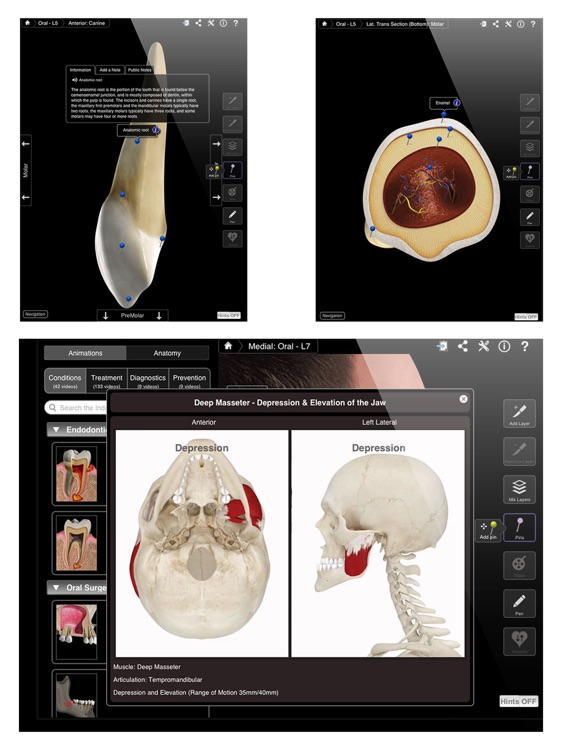 Dental Patient Education screenshot-3