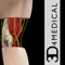 Elbow Pro III gives users an in depth look at the elbow, allowing them to cut, zoom & rotate the elbow