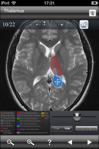 Brain MRI Sectional Walkerのおすすめ画像2