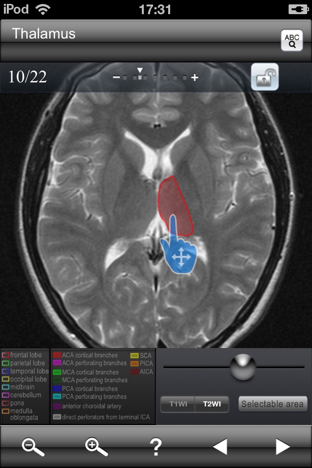 Brain MRI Sectional Walker screenshot 2