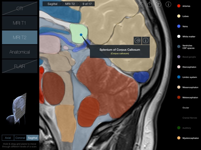 Radiology - Head(圖5)-速報App