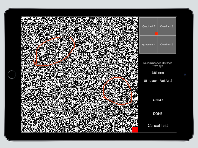 Visual Field Fast(圖3)-速報App