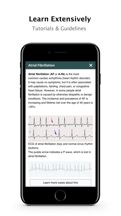 ECG - Cases, Exams and Tutorial for CME & EMT screenshot-4