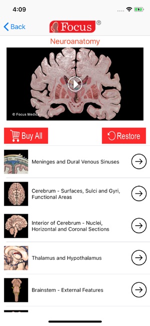 NEUROANATOMY - Digital Anatomy(圖2)-速報App