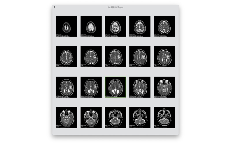 DICOM Quicklook by OsiriX