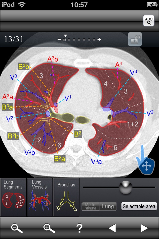 Chest CT Sectional Walker screenshot 2