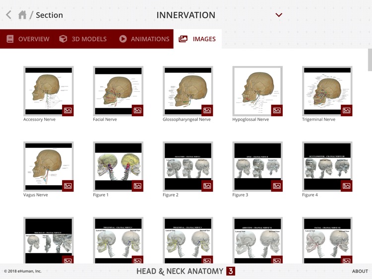 Head and Neck Anatomy 3 screenshot-8