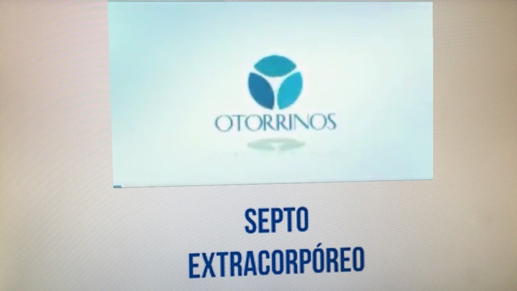 Otorrinos RA