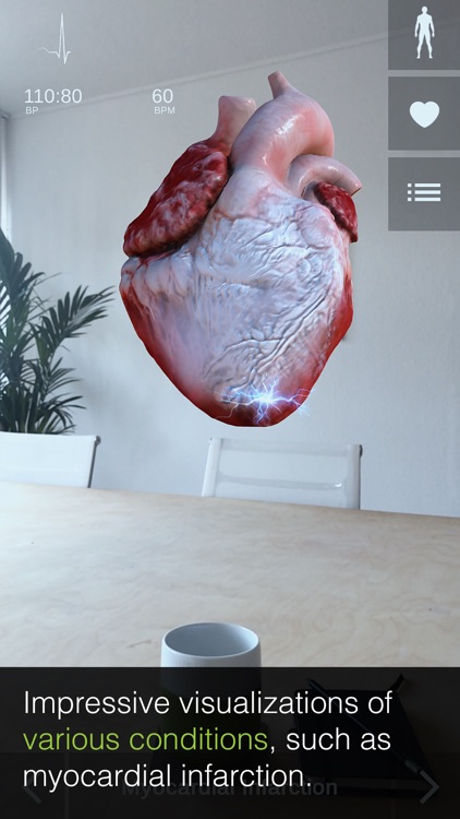 INSIGHT HEART screenshot-3