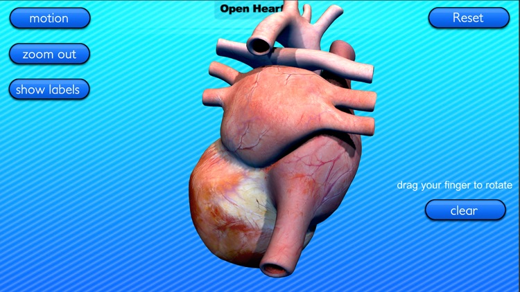 Open Heart Motion