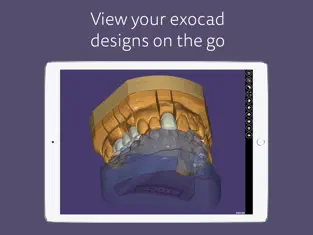 Captura de Pantalla 1 exocad webview - STL Viewer iphone