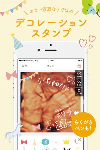 【mier】エコー写真をアレンジして妊娠期間をもっと楽しく！ screenshot 4