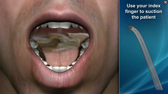 Medrills: Suctioning Airway(圖4)-速報App