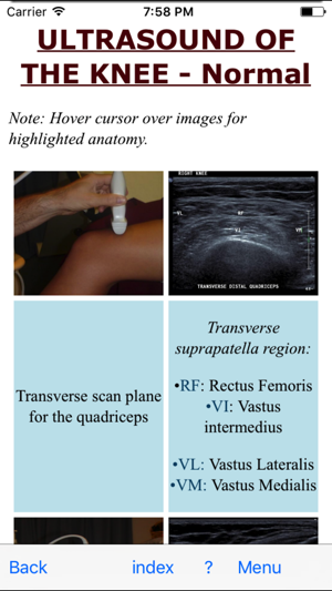 Ultrasoundpaedia(圖3)-速報App