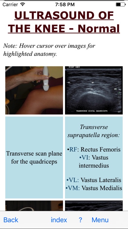 Ultrasoundpaedia