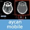 Demo account: User: aycan PW: aycan