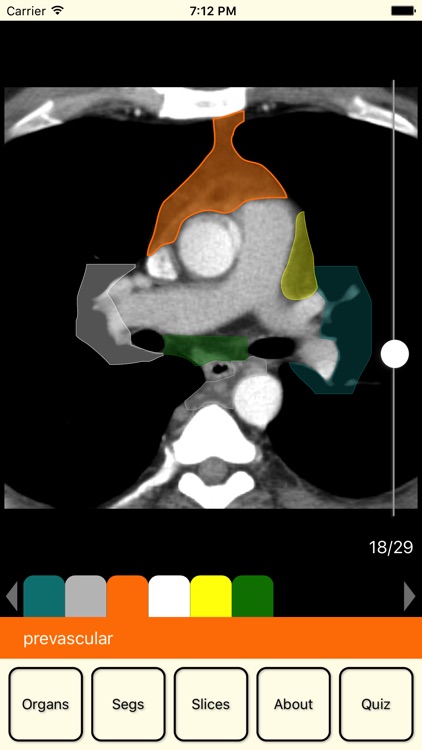 RadAnatomy
