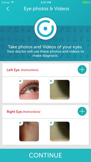 EyecareLive(圖8)-速報App